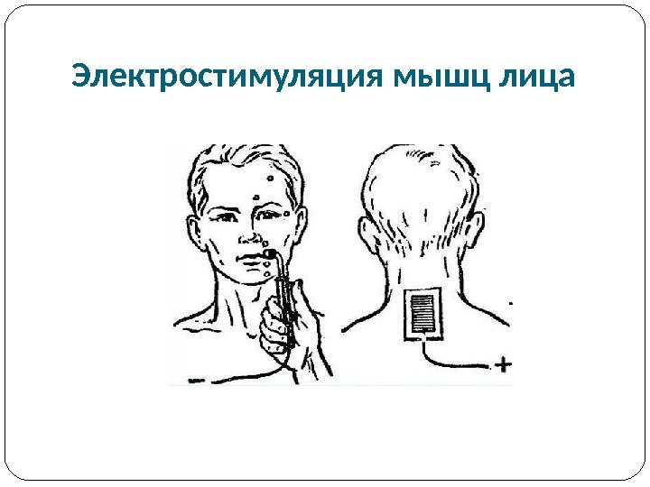 Импульсная терапия. Лечение импульсными токами низкой частоты и низкого н…